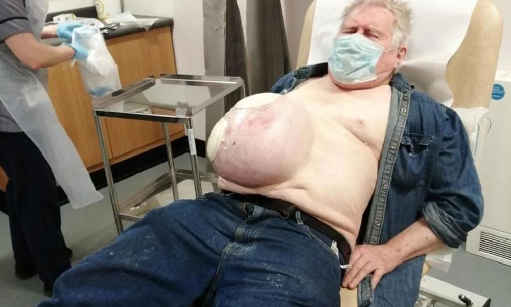 Βρετανία: Καθυστερούσε λόγω… COVID επείγουσα επέμβαση κήλης